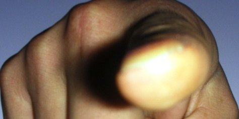 نيم ميليون اختلاس ديگر توسط مدير سابق سازمان ملل گری هلست!