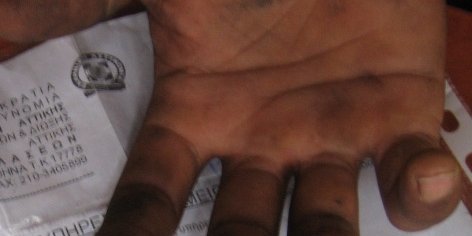 Greek: Homeless and Human Rights Abuse