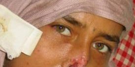 گوش و بينی نازيه قطع شد