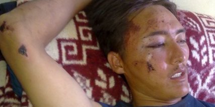 30 Afghan refugee families including women and children imprisoned in Greece